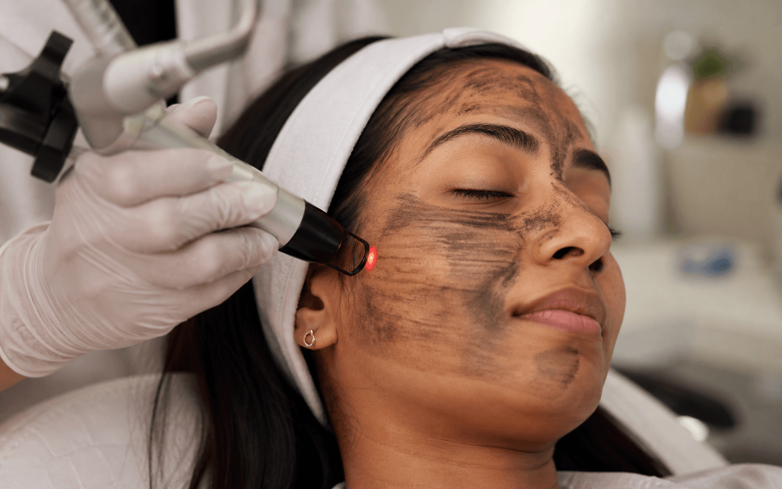 Carbon Facial